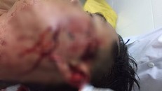 Theo kết quả giám định, tỉ lệ thương của Đại úy Nhiều là 15%. Ảnh: TTO