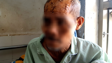 Cụ Đoàn Tám với chi chít những vết thương trên vùng đầu và mặt.