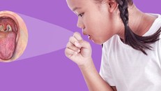 Chuyên gia khuyến cáo cách phân biệt bệnh bạch hầu với viêm họng, viêm amidan