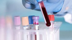 Các nhà khoa học đã tìm ra nguồn gốc của đông máu do COVID-19