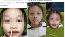 Cộng đồng phẫn nộ với thẩm mỹ viện xăm môi cho bé 5 tuổi để quảng cáo