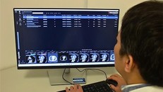 Bệnh lý tim mạch là nguyên nhân gây tử vong hàng đầu tại Việt Nam.