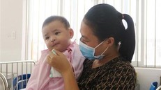 Một bệnh nhi mắc dị tật khe hở môi-vòm đã được phẫu thuật miễn phí tại Bệnh viện Nhi đồng 1. (Ảnh: Đinh Hằng/TTXVN)