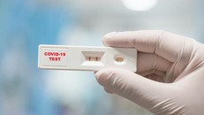 Giá test xét nghiệm COVID-19 đang có xu hướng giảm dần