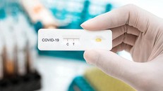 Bộ Y tế cần sớm tháo gỡ vướng mắc về giá các sinh phẩm xét nghiệm