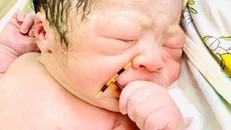 Kỳ diệu, cháu bé sơ sinh chào đời cùng chiếc vòng tránh thai. Ảnh do bệnh viện cung cấp