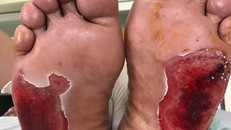 Người bệnh không nên tự ý dùng các loại đá chữa bệnh