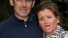 Rebecca và Nick với hàm răng "xộc xệch" vì tự nhổ