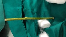 liên tục bị chảy máu âm đạo, đau bụng nhiều