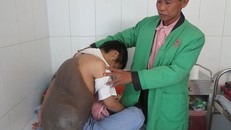 Chàng trai cõng mai rùa khổng lồ, 26 năm ngủ ngồi