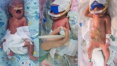 Ca sinh ba đặc biệt lần lượt chào đời cách nhau 47 giờ