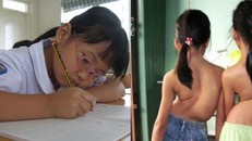 Trẻ bị cong vẹo cột sống vì những lý do đơn giản bố mẹ thường bỏ qua