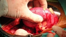 Luật pháp Việt Nam nghiêm cấm việc bán tạng (Ảnh minh họa)