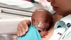 Bé trai 24 tuần nặng 600gr được cứu sống thần kỳ