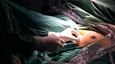 Việt Nam là nước đầu tiên trên thế giới thực hiện được kỹ thuật nội soi tuyến giáp một lỗ