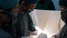 Các bác sĩ bệnh viện đa khoa huyện Đức Thọ (Hà Tĩnh) phẫu thuật cho bệnh nhân tắc ruột do ăn nhiều quả hồng (Ảnh: Trần Khoát)