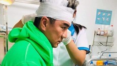 Hậu sự cố đổ máu trên sân khấu, phát ngôn của Đàm Vĩnh Hưng khiến khán giả chú ý