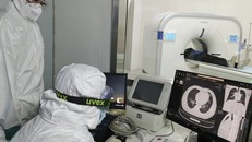 Virus corona có thể ‘trốn’ sâu trong phổi người đã khỏi bệnh