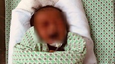 Bé trai bị bỏ rơi tại Sơn Tây hiện đang được điều trị tích cực tại BV ĐK SaintPaul