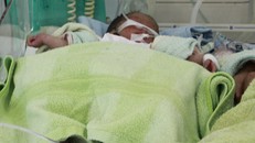 Bé gái sinh non đang được chăm sóc đặc biệt. Ảnh: Q.T.