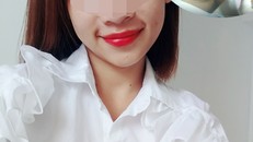 Cô gái bị hỏng một bên mắt sau khi tiêm filler nâng mũi. Ảnh: Nhân vật cung cấp.