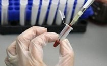 6 xét nghiệm máu cần làm trước 30 tuổi