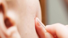 Nặn mụn không đúng cách có thể gây nguy hiểm tới tính mạng.