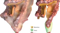 Mạc treo vốn được cho là một cấu trúc phân mảnh, nhưng nghiên cứu mới đã chỉ ra rằng nó là một trong những cơ quan riêng biệt của cơ thể. Ảnh: University Limerick.