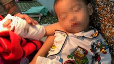 Sau ca mổ nối bàn tay, bé hiện được theo dõi tại bệnh viện.