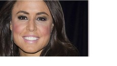 Fox News bị kiện vì quấy rối nhân viên cũ