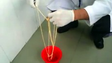 Sán xơ mít dài hơn 8 mét trong bụng người đàn ông 30 tuổi. Ảnh: Bệnh viện cung cấp.