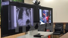 Một hệ thống y tế từ xa (Telemedicine). (Ảnh: TTXVN/Vietnam+)