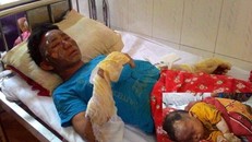 10 người trong gia đình bị bỏng do khí ga.