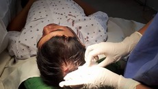 Vết thương dài đỉnh đầu khiến BS Long phải khâu 5 mũi