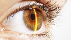 Ánh sáng mặt trời quá mạnh có thể gây tổn hại mắt