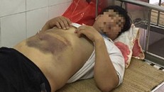 Hà Nội: Nhập viện cấp cứu sau khi công an mời lên làm việc