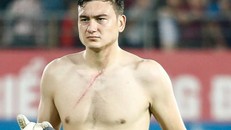 Sỹ Mạnh và Văn Lâm chính thức lên tiếng sau vụ việc “hành hung“