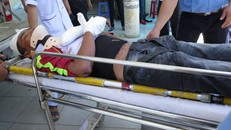 Nạn nhân vụ lật xe trên đèo Lê Khánh. Ảnh: Dân trí