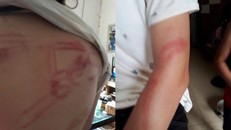 Hà Nội: Người bố dùng gậy nhôm đánh con trần tình sự việc
