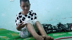 Chị Y Nhiêu - nạn nhân bị đánh đập, tra tấn. Ảnh: Báo Lao Động