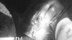 Vết đạn trên người nạn nhân. Ảnh: VietNamNet