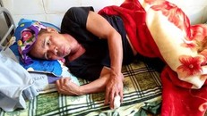 Ông Vi Văn Nhân bị mất đốt ngón tay, trên người còn nhiều vết thương sau khi bị lợn rừng tấn công. Ảnh: ANTĐ