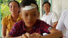 Em N.Q.A. bị thương vùng đầu sau khi bị bạn đánh tại trường. Ảnh: Tiền Phong