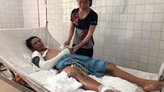 Bệnh nhân Gỏ hiện đã được nối liền đùi. Ảnh: PLO