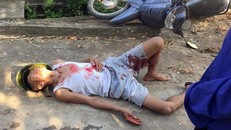 Hiện trường vụ tai nạn. Ảnh: Zing