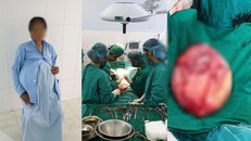 Người phụ nữ mang khối u buồng trứng nặng 25 kg