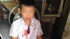 Cháu K. bị thương sau khi bị ông Đức hành hung.