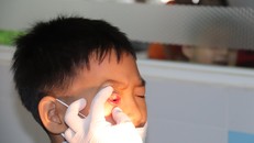 Dịch đau mắt đỏ lan rộng trên cả nước