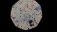 Biến đổi khí hậu cản trở cuộc chiến chống AIDS, lao và sốt rét