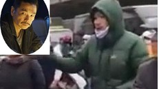 Nghệ sĩ Trung Anh đã bị đánh chảy máu đầu khi xô xát với tài xế lái taxi trên đường